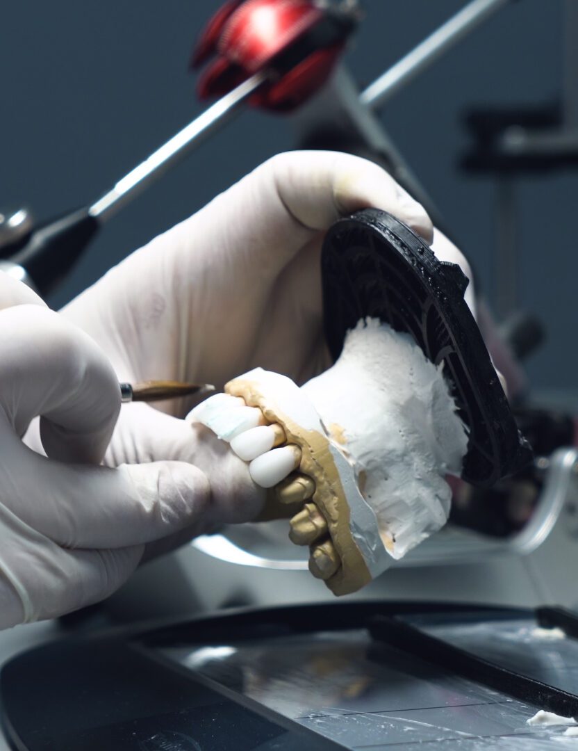dental crowns and bridges Classic Dental Lab UK