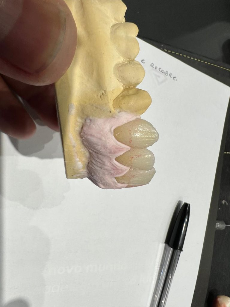 bridge Classic Dental Lab Folkestone Kent