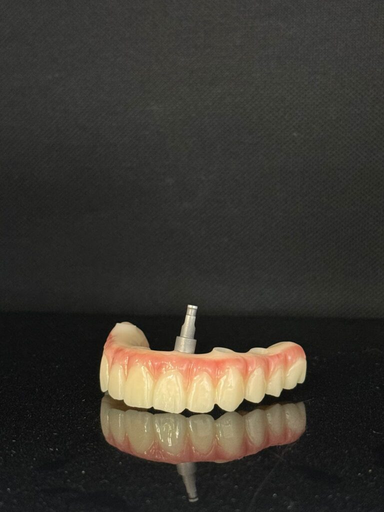 dental crown Classic Dental Lab UK