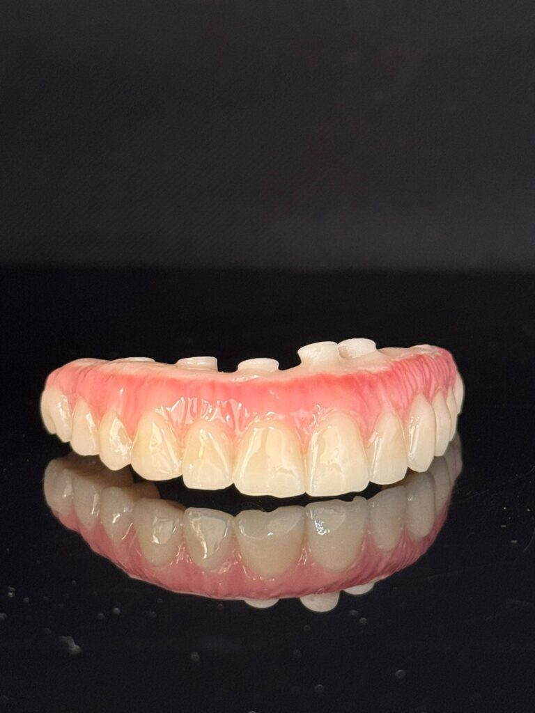 implant supported UK dental laboratory
