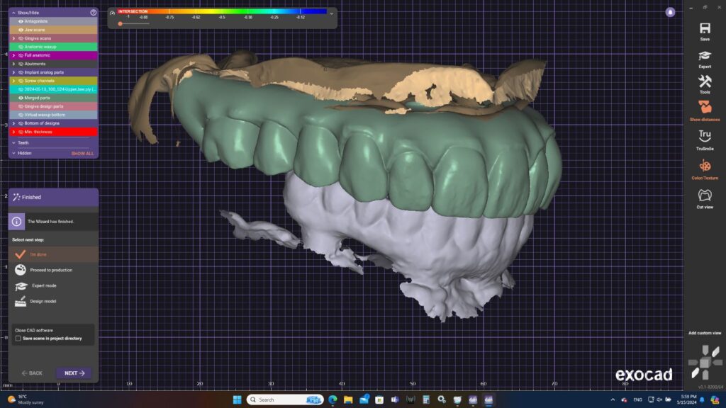 denture precision made UK dental restoration work Classic Dental Lab Kent