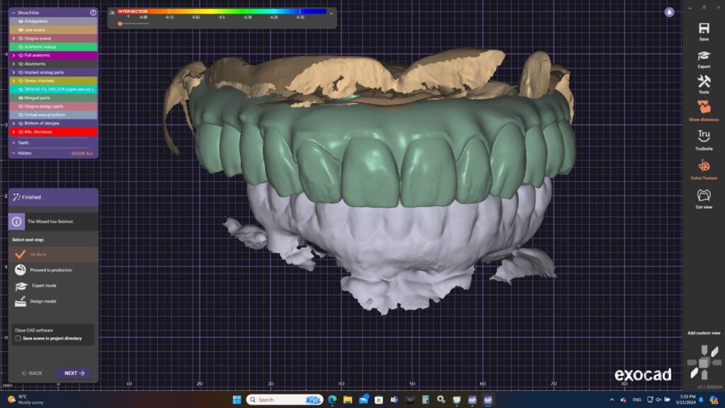 denture made UK dental restoration work Classic Dental Lab Kent