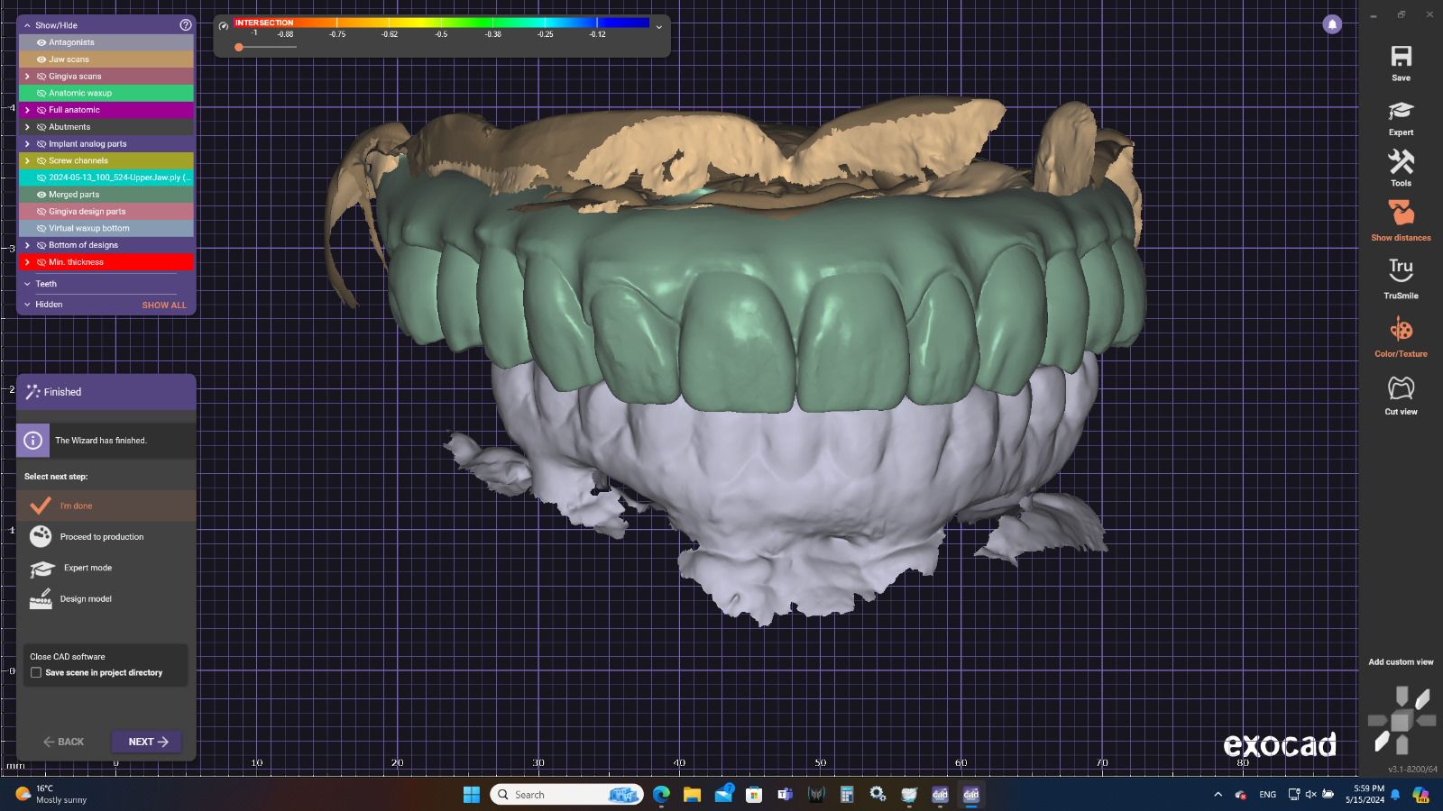 CAD CAM digital dentistry dental lab Kent Folkestone