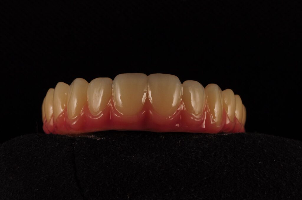 complete denture precision made UK dental lab Folkestone