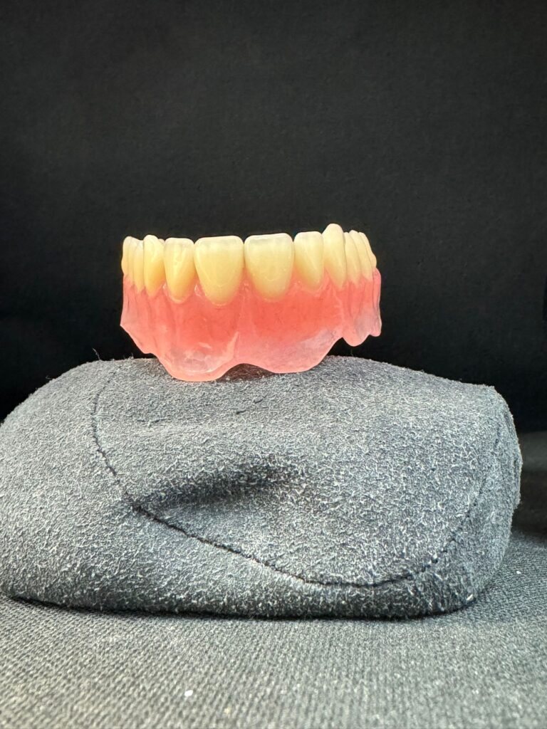 denture precision made UK dental lab Folkestone