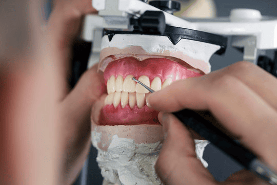GDC-registered dental technician manufacturing custom dental restorations at Classic Dental Lab — serving NHS and private dental practices across the UK
