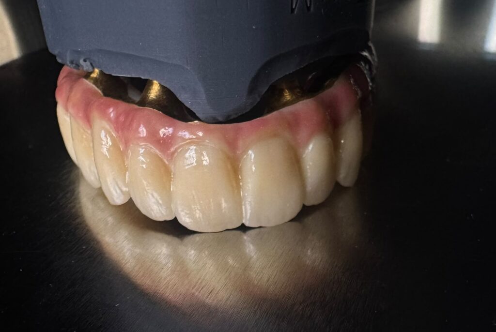 Complete denture precision made By Classic dental lab UK
