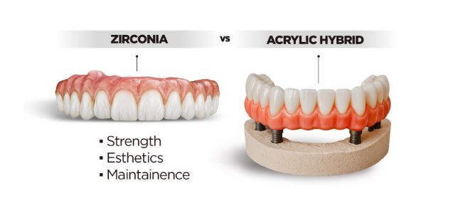 Comparison of Zirconia vs Acrylic Hybrid implant supported denture designs