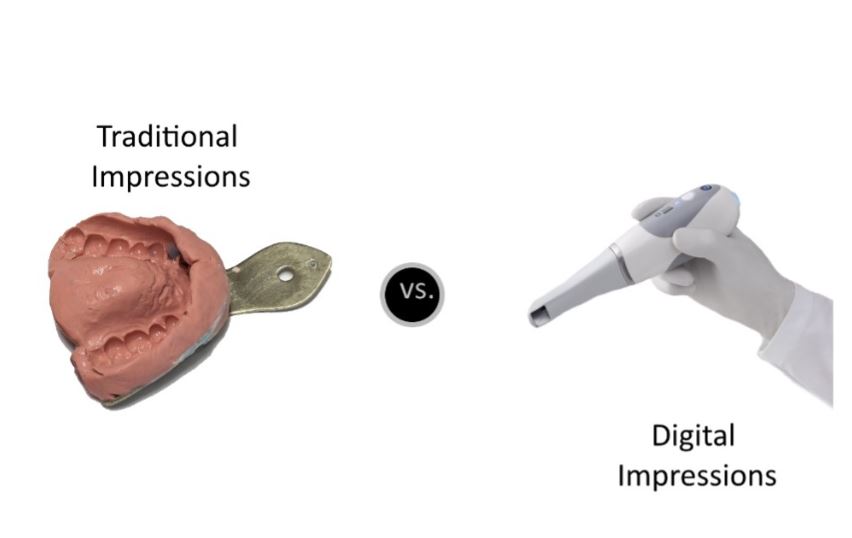 comparison of Digital impressions vs conventional impressions